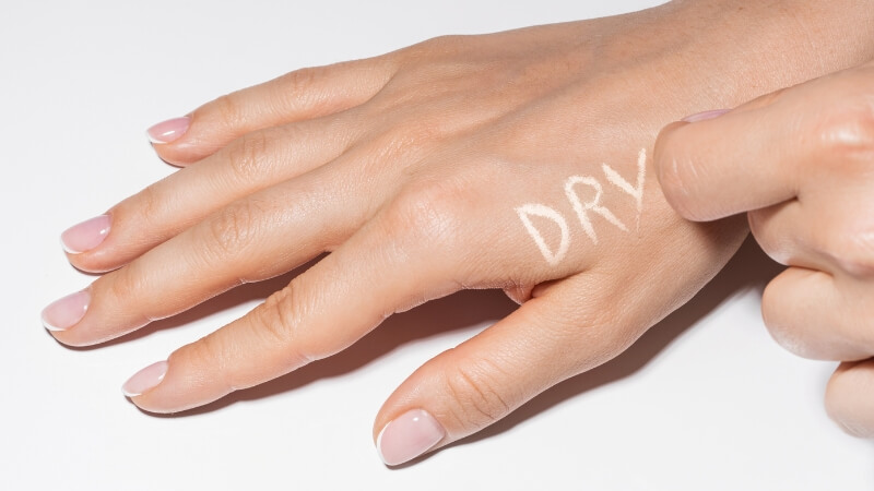 dry skin